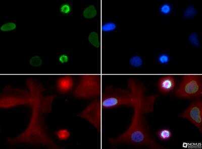 Immunocytochemistry/ Immunofluorescence: Histone H4 [ac Lys5] Antibody - BSA Free [NB21-2024]